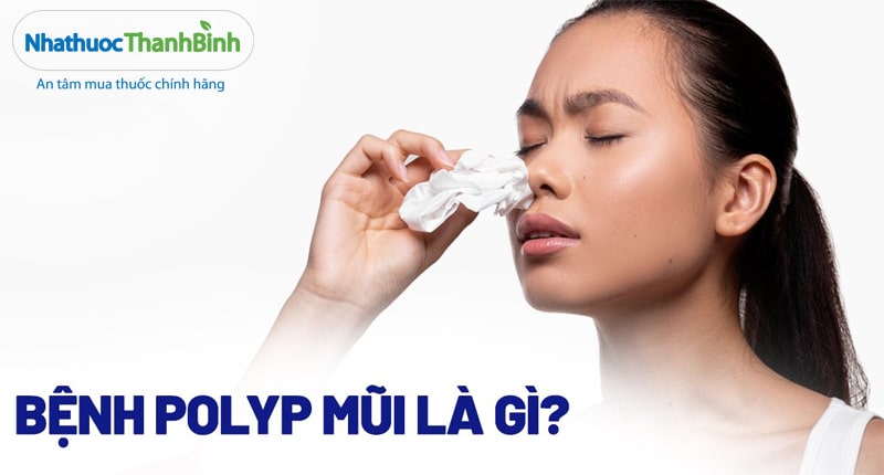 Polyp mũi là một dạng u lành tính xuất hiện ở hốc mũi và xoang mặt