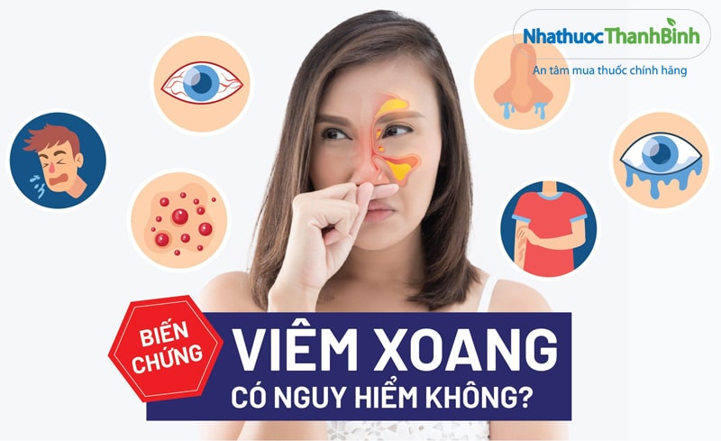 Viêm xoang kéo dài có thể gây ra nhiều biến chứng nguy hiểm