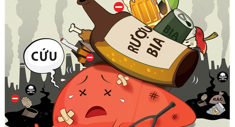 Sử dụng nhiều rượu bia gây hại nhiều cho gan và cơ thể