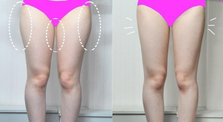 Baschi giúp giảm mỡ thừa vùng bắp chân