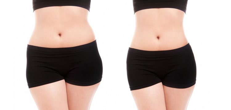 Excel Slim giúp giảm cân hiệu quả nhanh chóng an toàn