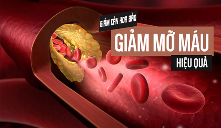 Viên giảm cân Hoa Bảo giúp hỗ trợ hạ mỡ máu hiệu quả