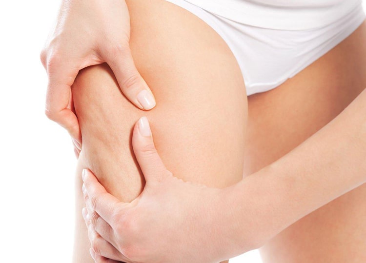 Sản phẩm giúp giảm béo đặc biệt ở vùng eo, bụng, đùi, bắp tay