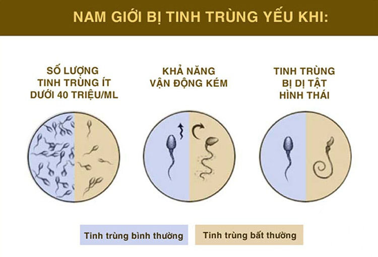 Thuốc dùng cho nam giới tinh trùng yếu, ít, loãng, dị tật nhiều