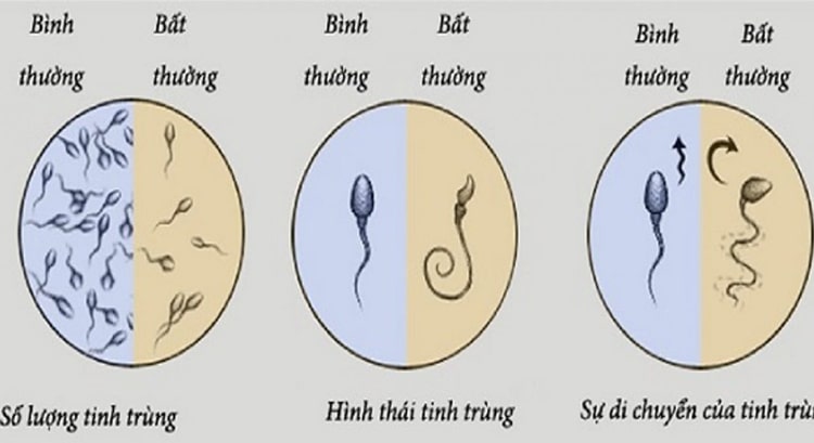 Viên sủi Motil dùng cho nam giới hiếm muộn tinh trùng yếu, sinh lý yếu