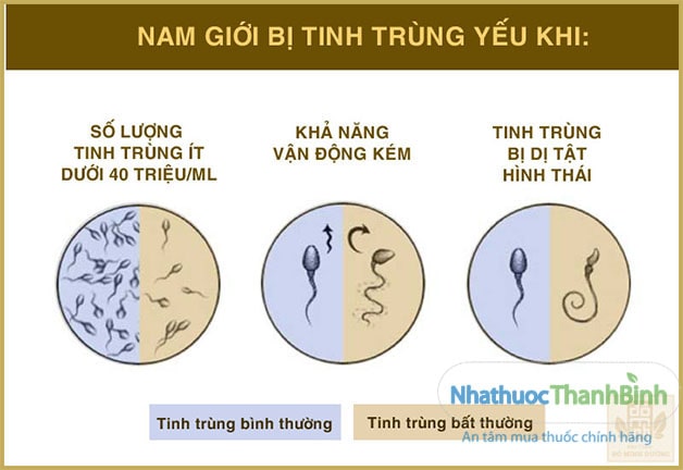 Dấu hiệu tinh trùng yếu