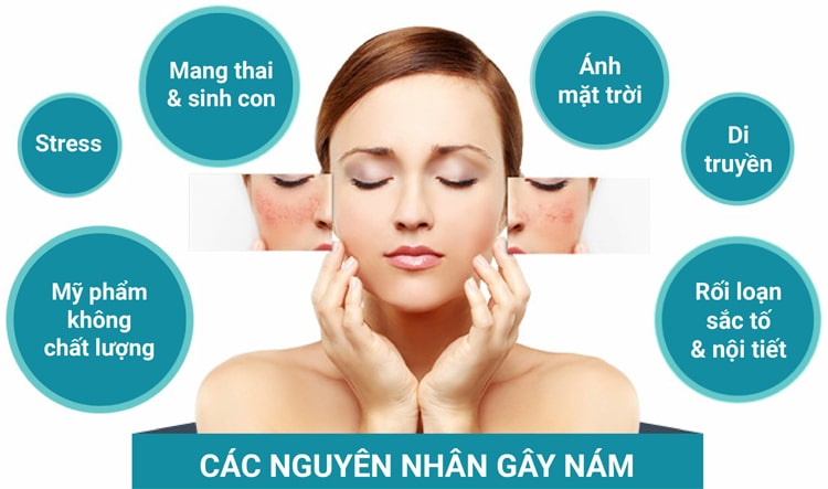 Những nguyên nhân gây ra nám da