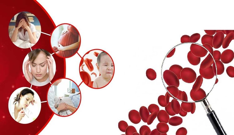 Solufemo hỗ trợ điều trị thiếu máu do thiếu sắt