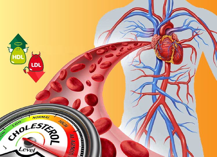 Minaphar life giúp hỗ trợ giảm Cholesterol xấu trong máu