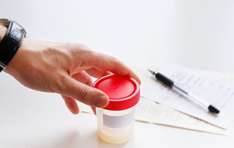 Xét nghiệm tinh dịch đồ giúp chẩn đoán và điều trị vô sinh hiếm muộn ở nam giới