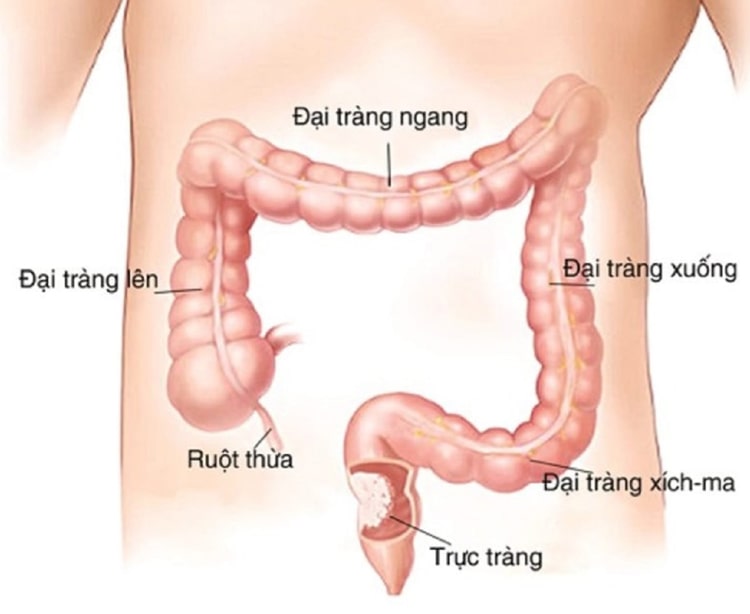 Fiber Family giúp nhuận tràng hỗ trợ tiêu hóa hiệu quả