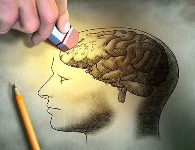 Bệnh Alzheimer được coi là căn bệnh trầm trọng của não bộ