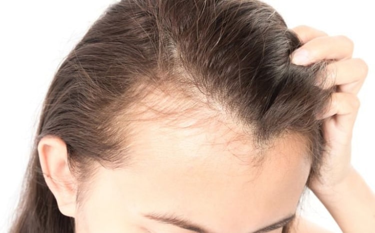 TPCN Hair Skin Nails Paris dùng cho người thường xuyên rụng tóc, khô sạm da